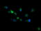 RIO Kinase 2 antibody, M09743, Boster Biological Technology, Immunofluorescence image 