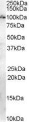 Anillin Actin Binding Protein antibody, PA5-18540, Invitrogen Antibodies, Western Blot image 