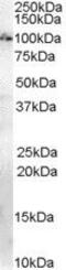 Anillin Actin Binding Protein antibody, PA5-18540, Invitrogen Antibodies, Western Blot image 