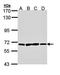 Poly(A) Specific Ribonuclease Subunit PAN3 antibody, orb69858, Biorbyt, Western Blot image 