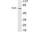 Uromodulin antibody, LS-C200025, Lifespan Biosciences, Western Blot image 