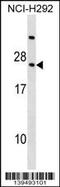 Phospholipase A And Acyltransferase 4 antibody, 60-161, ProSci, Western Blot image 