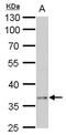 Pancreas Associated Transcription Factor 1a antibody, PA5-78664, Invitrogen Antibodies, Western Blot image 