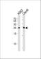 MOB Kinase Activator 1B antibody, A09405-3, Boster Biological Technology, Western Blot image 