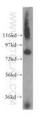 CCR4-NOT Transcription Complex Subunit 10 antibody, 15938-1-AP, Proteintech Group, Western Blot image 