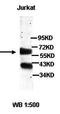 Adenylate Kinase 2 antibody, orb77423, Biorbyt, Western Blot image 