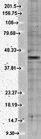Potassium Voltage-Gated Channel Subfamily J Member 12 antibody, orb67401, Biorbyt, Western Blot image 