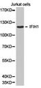 Interferon Induced With Helicase C Domain 1 antibody, TA327337, Origene, Western Blot image 