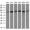 Galactosidase Beta 1 antibody, M01829-2, Boster Biological Technology, Western Blot image 