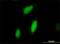 Ribosomal Protein S6 Kinase A3 antibody, H00006197-M01, Novus Biologicals, Immunocytochemistry image 