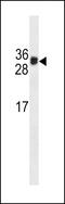 Kallikrein Related Peptidase 3 antibody, LS-C159839, Lifespan Biosciences, Western Blot image 