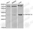 TNF Receptor Superfamily Member 1A antibody, A0033, ABclonal Technology, Western Blot image 