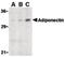 Adiponectin, C1Q And Collagen Domain Containing antibody, LS-C19515, Lifespan Biosciences, Western Blot image 