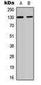 Integrin Subunit Alpha E antibody, LS-C356135, Lifespan Biosciences, Western Blot image 