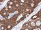 Keratin 8 antibody, NBP2-16094, Novus Biologicals, Immunohistochemistry paraffin image 