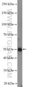 FGFR1 Oncogene Partner antibody, 11343-1-AP, Proteintech Group, Western Blot image 