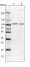 VPS53 Subunit Of GARP Complex antibody, NBP1-83798, Novus Biologicals, Western Blot image 