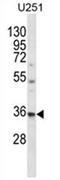 VPS37B Subunit Of ESCRT-I antibody, AP54515PU-N, Origene, Western Blot image 