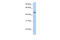 Nuclear RNA Export Factor 3 antibody, 25-656, ProSci, Enzyme Linked Immunosorbent Assay image 