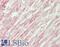 Microtubule Affinity Regulating Kinase 2 antibody, LS-B14681, Lifespan Biosciences, Immunohistochemistry paraffin image 