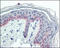 Keratin 5 antibody, abx010566, Abbexa, Enzyme Linked Immunosorbent Assay image 