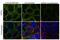 Receptor Interacting Serine/Threonine Kinase 1 antibody, 711689, Invitrogen Antibodies, Immunocytochemistry image 