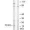 Tumor necrosis factor alpha-induced protein 8 antibody, A05158, Boster Biological Technology, Western Blot image 