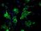 Vasodilator Stimulated Phosphoprotein antibody, NBP2-00555, Novus Biologicals, Immunocytochemistry image 