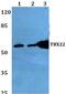 T-Box 22 antibody, PA5-75266, Invitrogen Antibodies, Western Blot image 