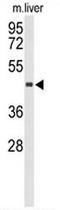 Chitinase Acidic antibody, AP50895PU-N, Origene, Western Blot image 