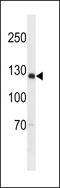 Shugoshin 2 antibody, LS-C156064, Lifespan Biosciences, Western Blot image 
