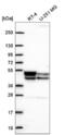 Pyruvate Dehydrogenase Kinase 3 antibody, NBP2-56356, Novus Biologicals, Western Blot image 
