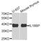 Interleukin 18 Binding Protein antibody, PA5-76009, Invitrogen Antibodies, Western Blot image 