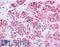 ATP Binding Cassette Subfamily B Member 1 antibody, LS-B4675, Lifespan Biosciences, Immunohistochemistry paraffin image 