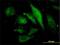 Microtubule Associated Protein RP/EB Family Member 2 antibody, H00010982-M03, Novus Biologicals, Immunofluorescence image 