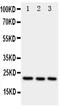 Peroxiredoxin 1 antibody, PA1772, Boster Biological Technology, Western Blot image 
