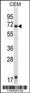 Histamine Receptor H1 antibody, 57-725, ProSci, Western Blot image 