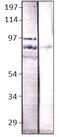 Bestrophin-4 antibody, GTX47908, GeneTex, Western Blot image 