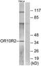 Olfactory Receptor Family 10 Subfamily R Member 2 antibody, TA316369, Origene, Western Blot image 