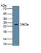 Cytochrome P450 Family 19 Subfamily A Member 1 antibody, LS-C693769, Lifespan Biosciences, Western Blot image 