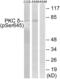 Protein Kinase C Delta antibody, abx012562, Abbexa, Western Blot image 