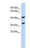 Ankyrin Repeat And SOCS Box Containing 8 antibody, NBP1-58904, Novus Biologicals, Western Blot image 