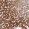 Nicotinamide N-Methyltransferase antibody, NBP2-32438, Novus Biologicals, Immunohistochemistry paraffin image 