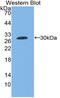 Coagulation Factor III, Tissue Factor antibody, MBS2025655, MyBioSource, Western Blot image 