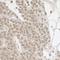 RBM17 antibody, A302-497A, Bethyl Labs, Immunohistochemistry paraffin image 