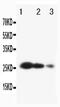 TIMP Metallopeptidase Inhibitor 3 antibody, PA5-80131, Invitrogen Antibodies, Western Blot image 