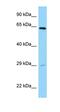Sorting Nexin 11 antibody, orb330810, Biorbyt, Western Blot image 