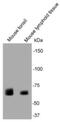 Protein Tyrosine Phosphatase Non-Receptor Type 6 antibody, NBP2-67086, Novus Biologicals, Western Blot image 