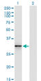 Cyclin Dependent Kinase 5 antibody, LS-C196881, Lifespan Biosciences, Western Blot image 