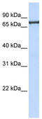 Transportin 2 antibody, TA334487, Origene, Western Blot image 